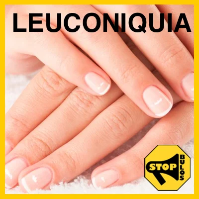 ¿¿Las manchas blancas de las uñas son por falta de calcio??